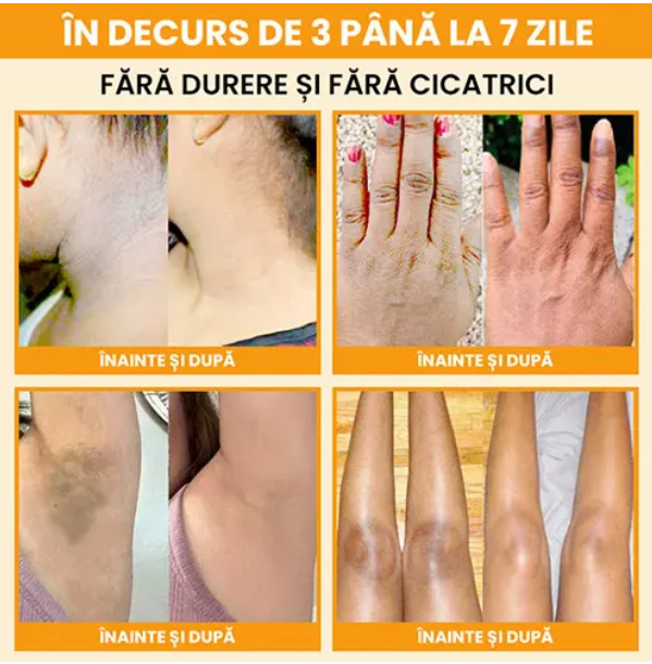 Gel exfoliant enzimatic cu portocale - Pentru fata si corp, 100g