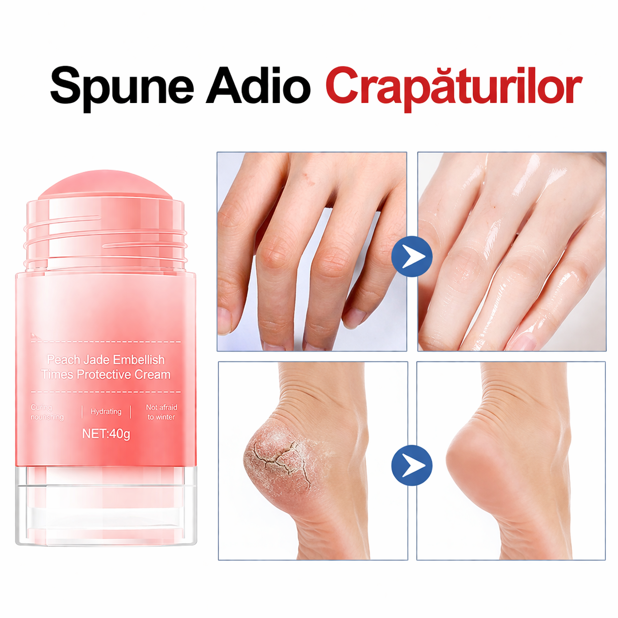 Roller Natural Impotriva Crapaturilor Si Pielii Moarte ( Pentru Picioare Si Maini)
