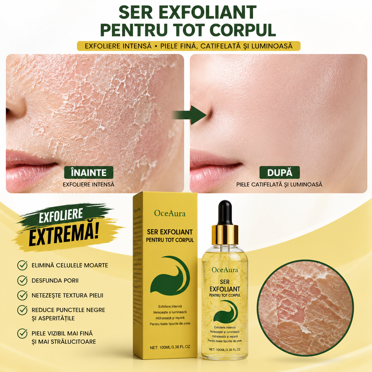 Ser Exfoliant - Se Poate Folosi Pe Orice Zona A Corpului 100ML